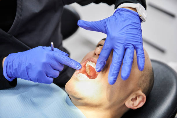 Best Emergency Root Canal Treatment in Redland, MD